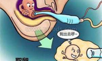 同房精子没有流出会怀孕吗