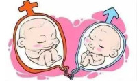 上环怀孕怎么办呢